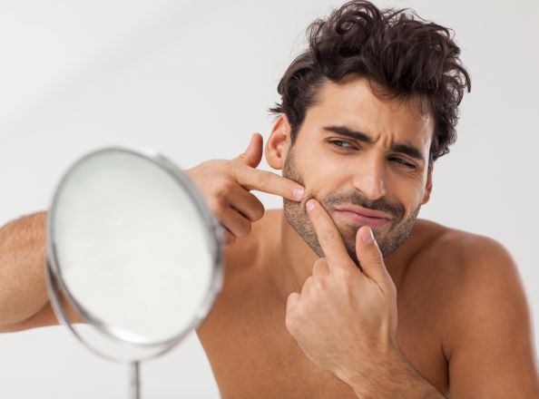 Facial hair and acne | Do beards cause acne?