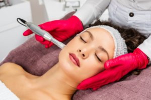 Woman receiving microneedling treatment