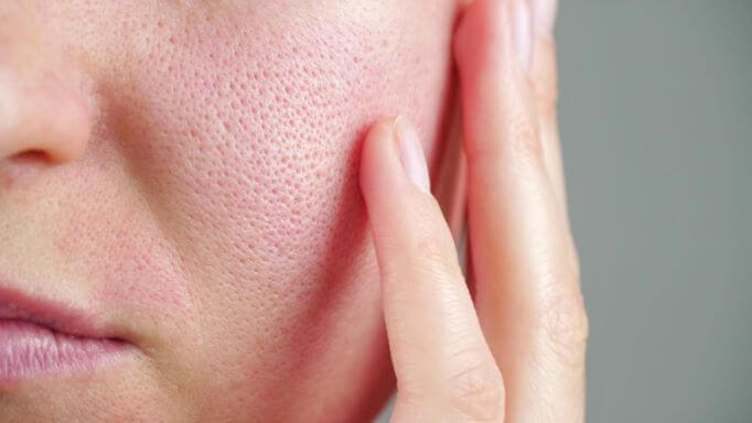 woman wonders how to shrink pores