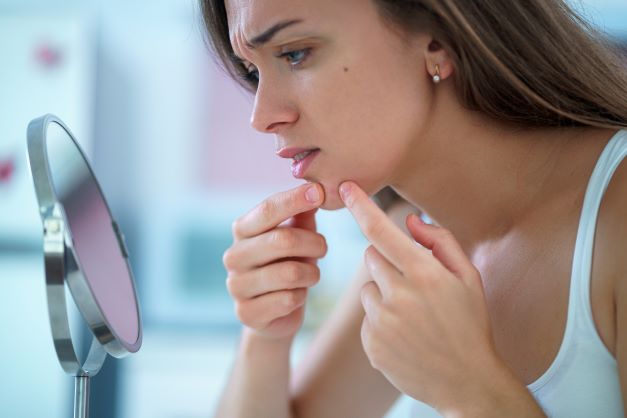 teenage girl wonders is popping pimples bad?