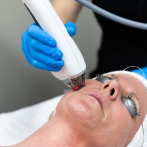 MOXI Laser Treatment Service Page