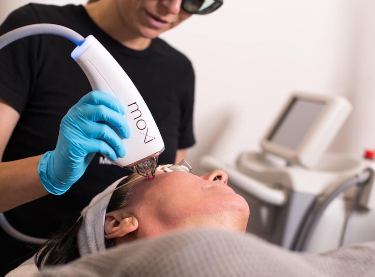 MOXI Laser Treatment U.S. Dermatology Partners