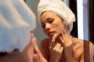 Woman looks in the mirror and wonders how to minimize acne scars