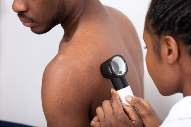 Closeup image of an african American dermatologist examining a patient's back