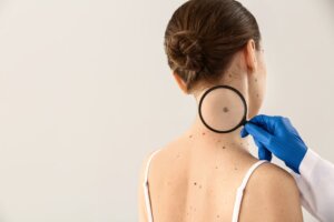 woman receiving a skin cancer exam