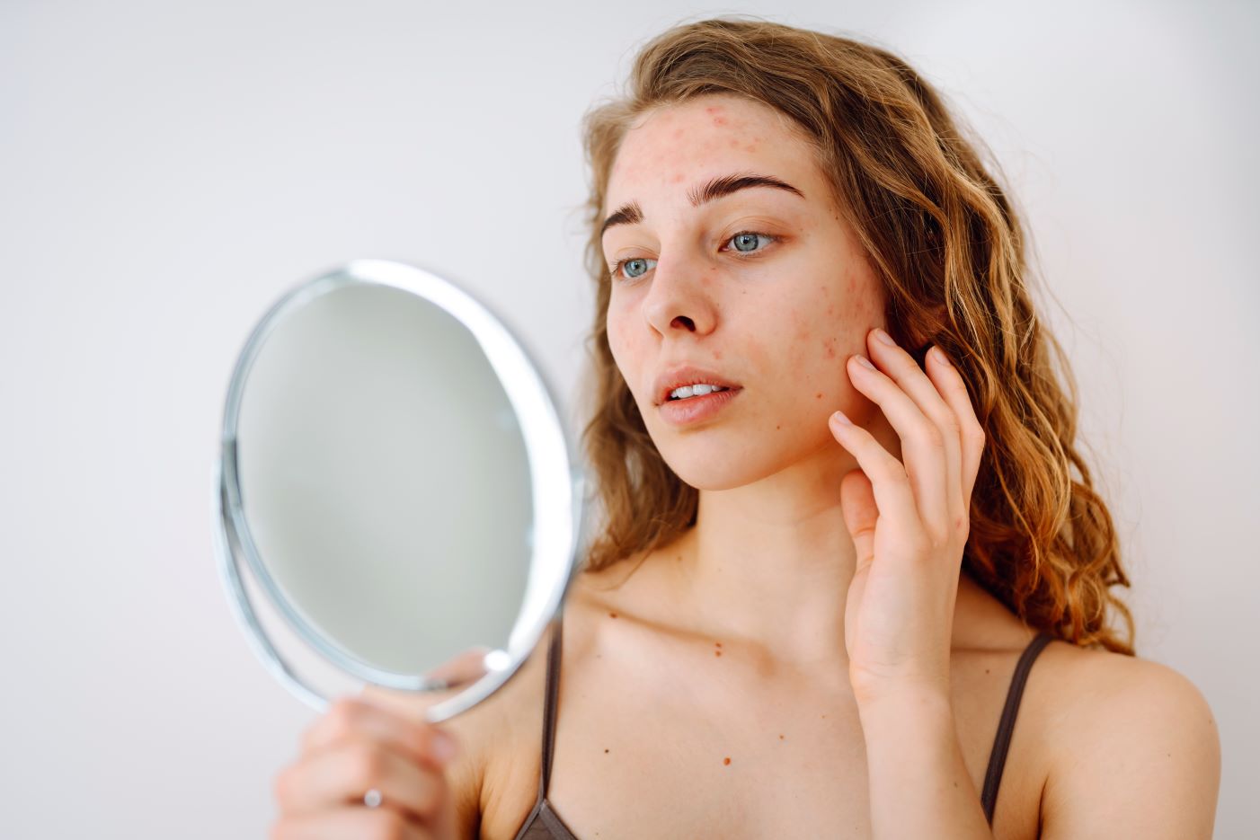 Woman looking at acne like symptoms in the mirror