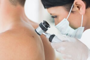 patient with melanoma is examined by a dermatologist