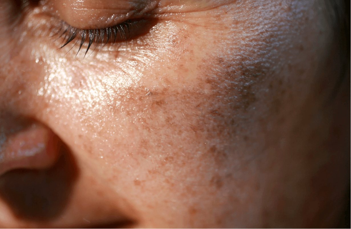 Dermatology Times - From Earth to Skin- Reviewing the Role of Environmental Factors in Dermatologic Conditions - Jennifer Holman, MD, FAAD
