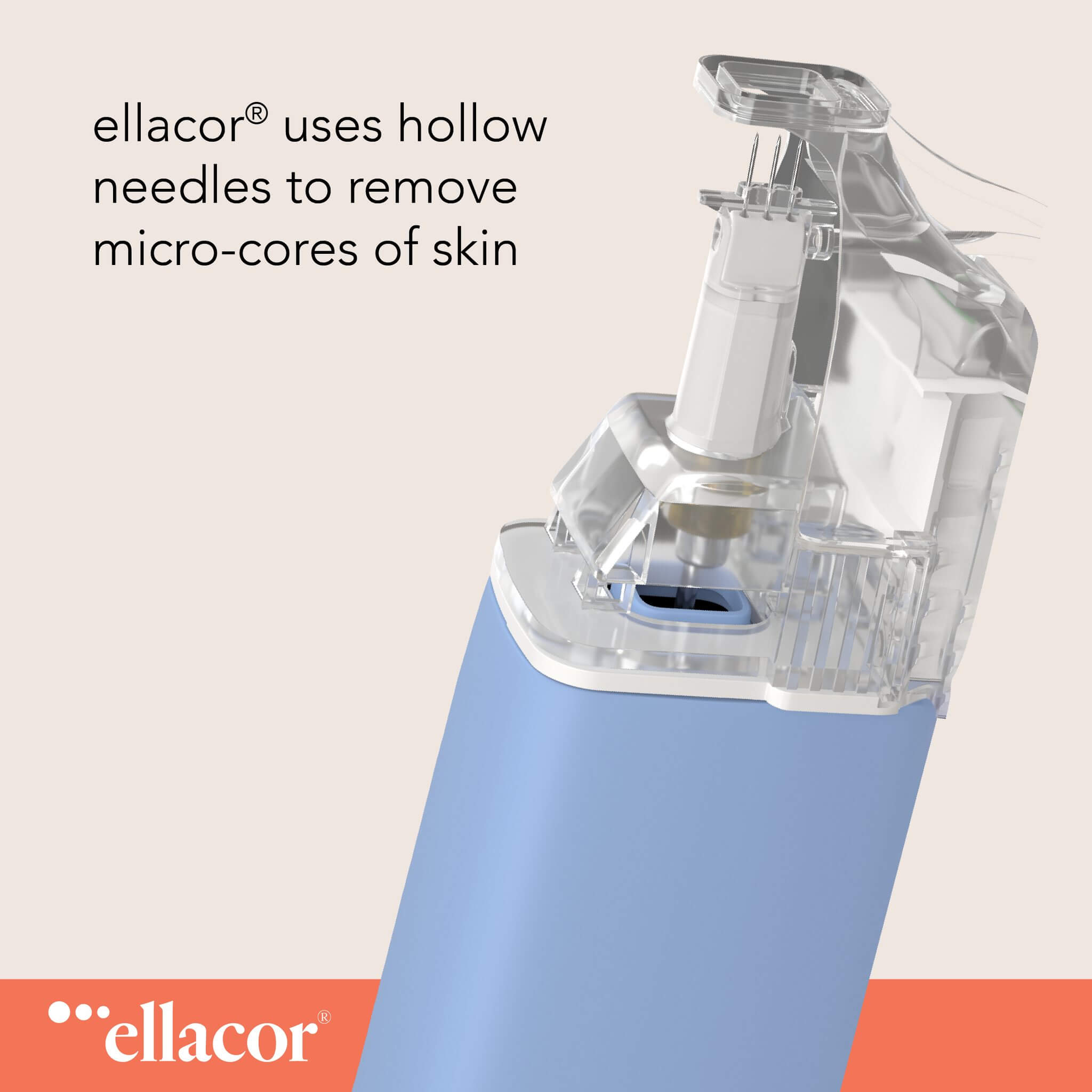 ellacor uses hollow needles to remove micro-cores of skin