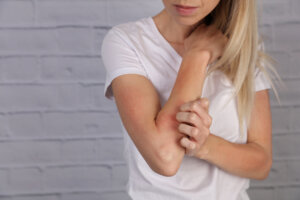 A women in a white shirt scratching her irritated, red elbow against a gray brick wall background.