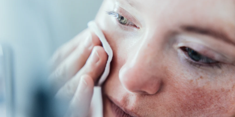 Today - Struggling with Facial Redness Discover Expert Tips to Soothe Your Skin