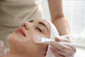 when to get a chemical peel